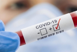 Armenia's Covid-19 infections grew by 135 in the past day