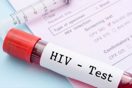 Scientists spot more destructive HIV variant