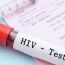 Scientists spot more destructive HIV variant