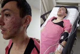 Թուրքիայում 5 հոգով հարձակվել են աուտիզմով հայ երիտասարդի վրա և ծեծել նրան
