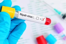 ԱՀԿ-ն Նիպահ վիրուսի համաշխարհային տարածման վտանգը ցածր է գնահատել